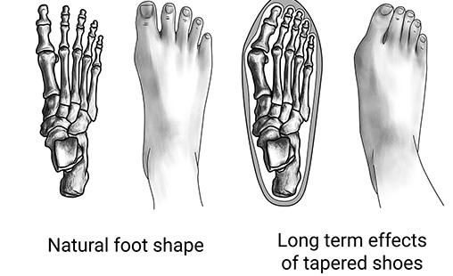 Footshape