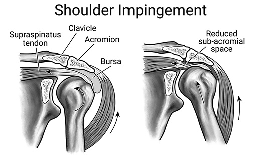 Shoulder