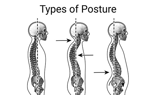 Spine1